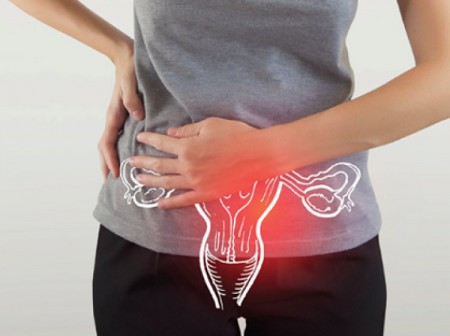 Darkolates for PCOS/PCOD